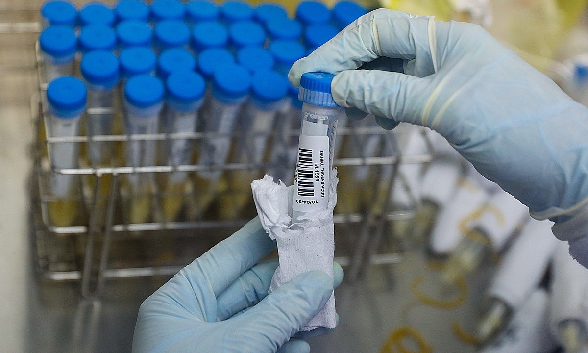 phongxetnghiemcovid19211585-15-2895-5577