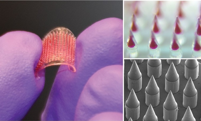Vietnamese scientist develops skin patch vaccine technology - VnExpress International - Vimarsana News